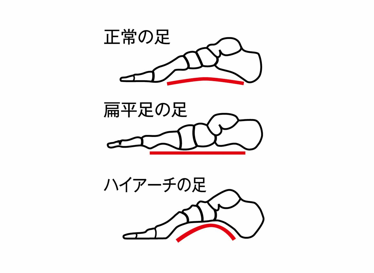 ソルボタテアーチシームレスサポーター解説