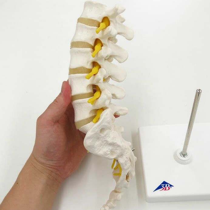 腰椎モデル（ヘルニア付）