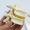 6個の脊椎モデル　胸椎