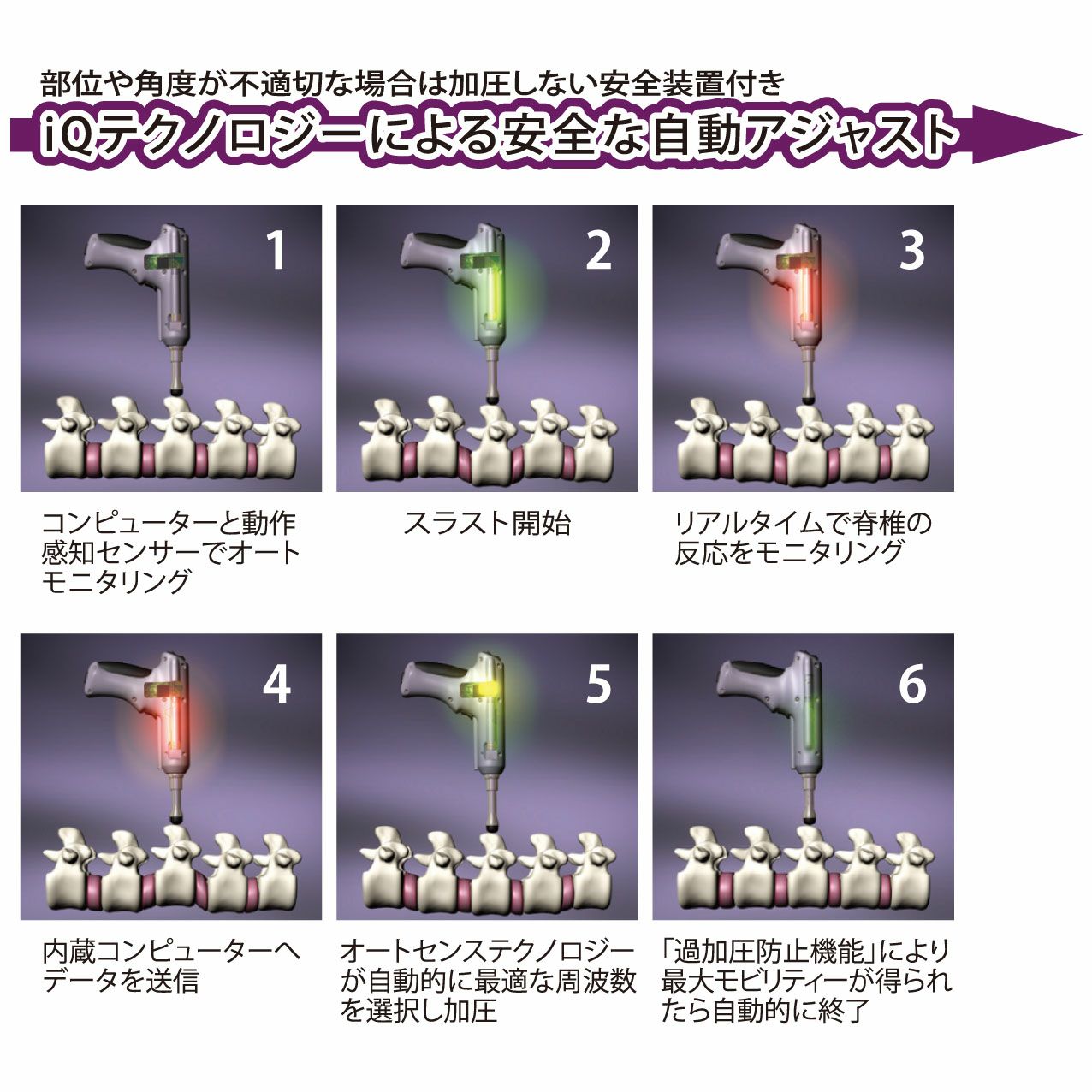 インパルス iQ 解説